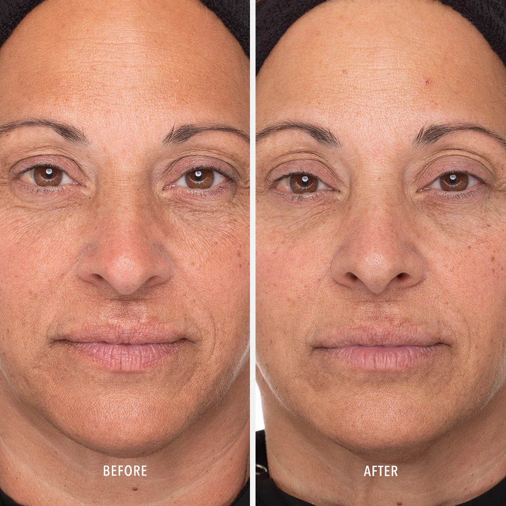 HydroPeptide Retinol Routine Booster | 1% Retinol Solution