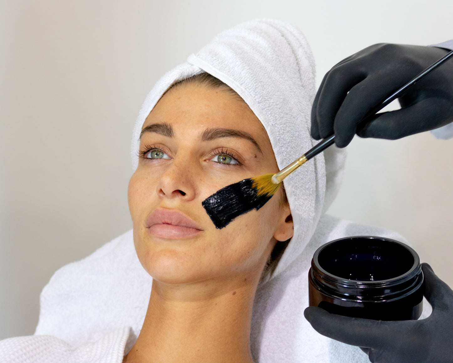 V Carbon Peel " The Hollywood Facial" Package of (3) Treatments